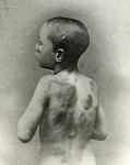 Click image for larger version. 

Name:	1900 BOY CRUELLY NEGLECTED BY PARENTS FILE 15534 MGA014428.jpg 
Views:	1200 
Size:	108.4 KB 
ID:	933